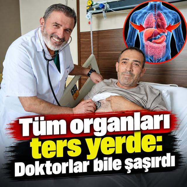 Tüm organları ters yerde: Doktorlar bile şaşırdı