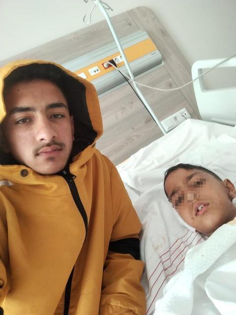 Okul yolunda dehşet! Sokak köpeği küçük çocuğa saldırdı