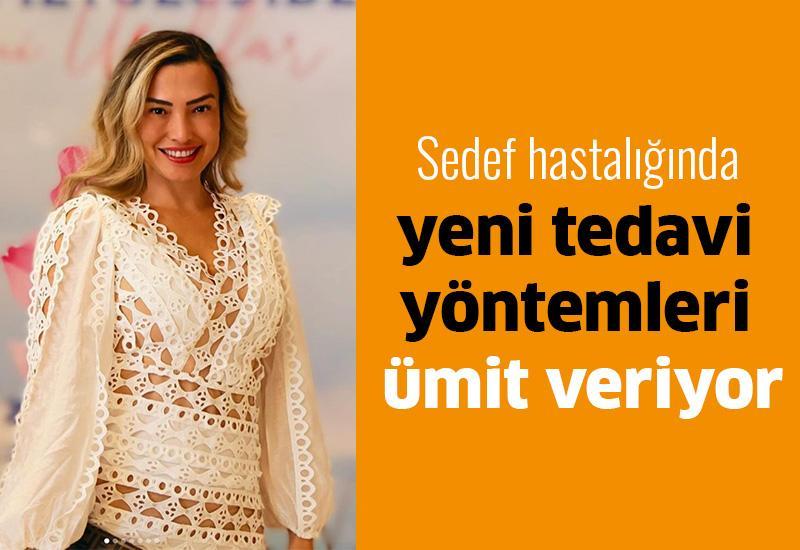 Sedef hastalığında yeni tedavi yöntemleri ümit veriyor