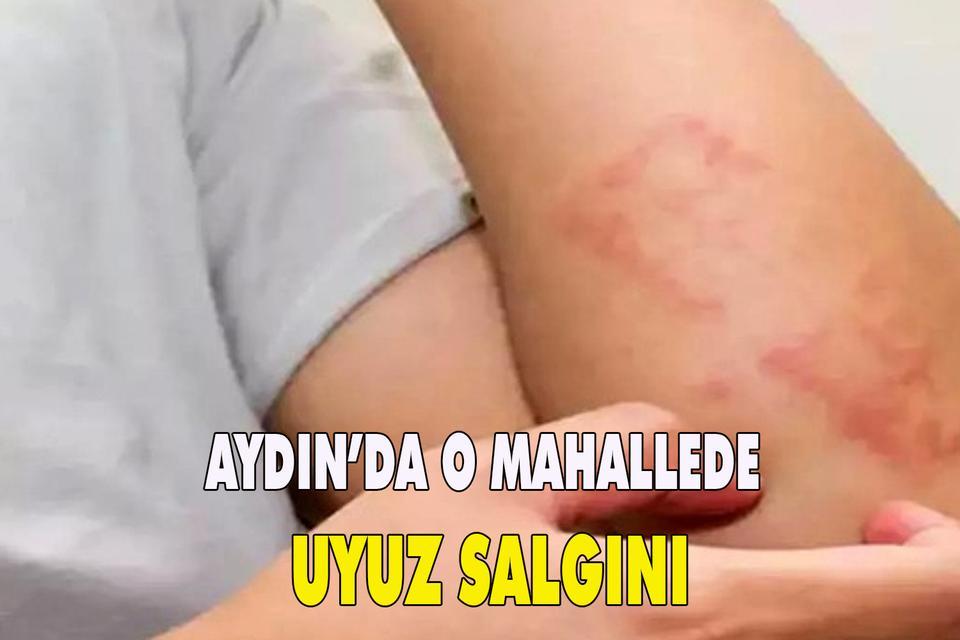 Aydın’da o mahallede uyuz salgını