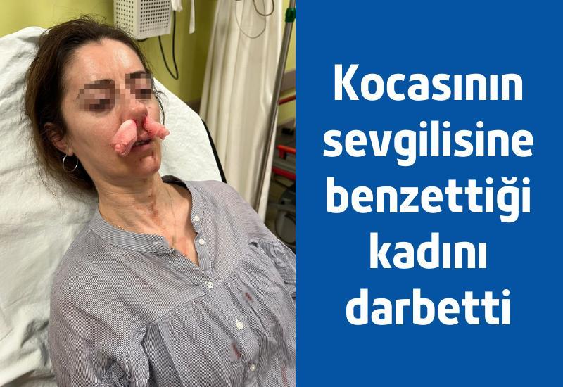 Kocasının sevgilisine benzettiği kadını darbetti